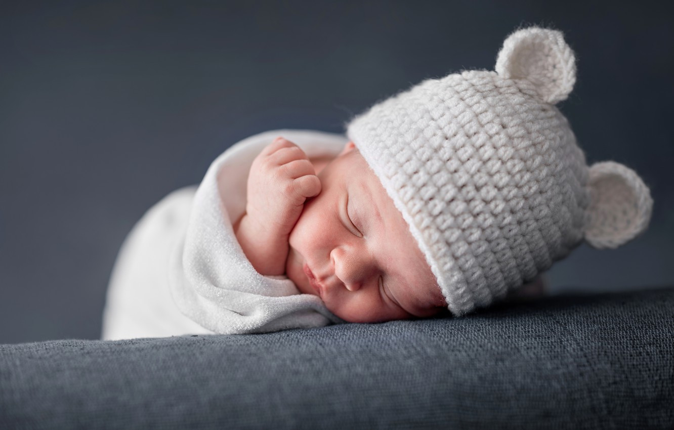 Anencephaly